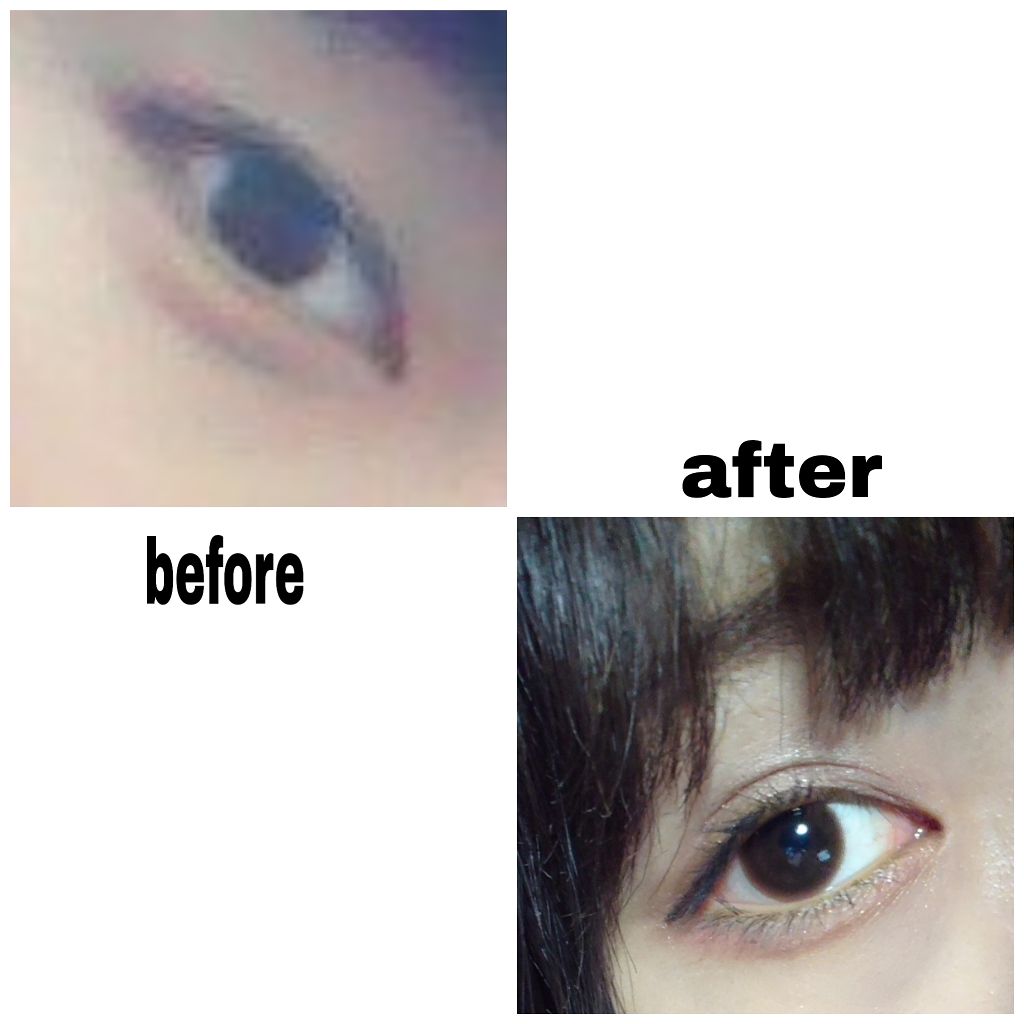 アイトーク/アイトーク/二重まぶた用アイテムを使ったクチコミ(1枚目)