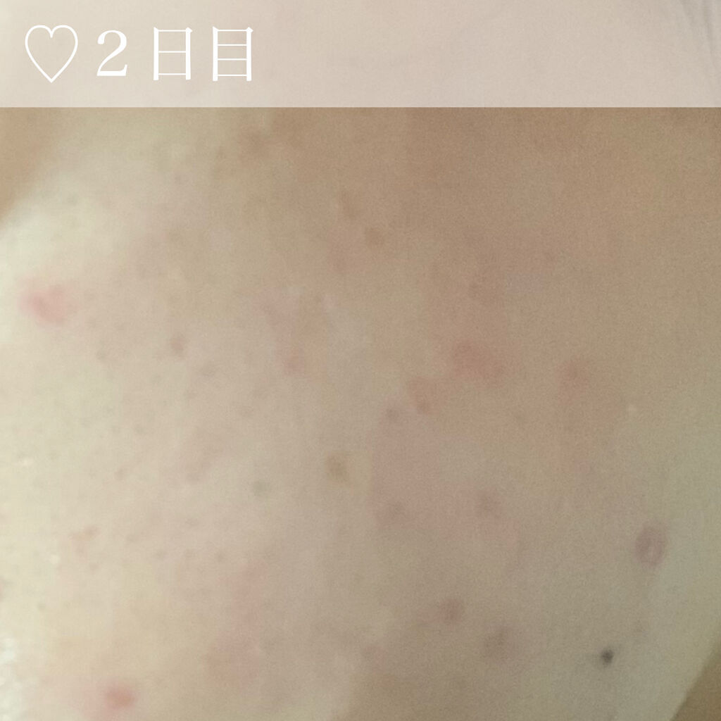 ジルスチュアート リップバーム/JILL STUART/リップバームを使ったクチコミ（3枚目）