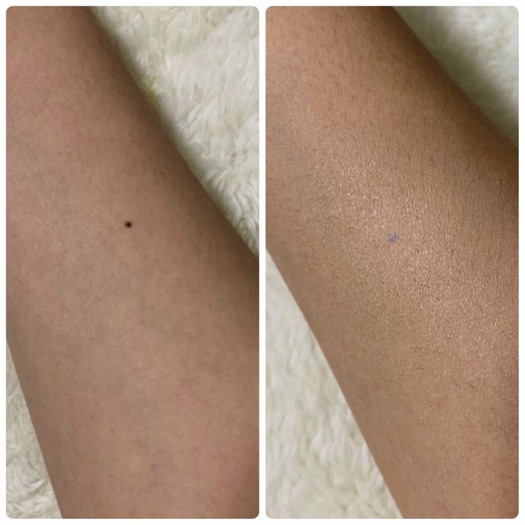 アンクル ド ポー ルクッションN/YVES SAINT LAURENT BEAUTE/クッションファンデーションを使ったクチコミ(4枚目)