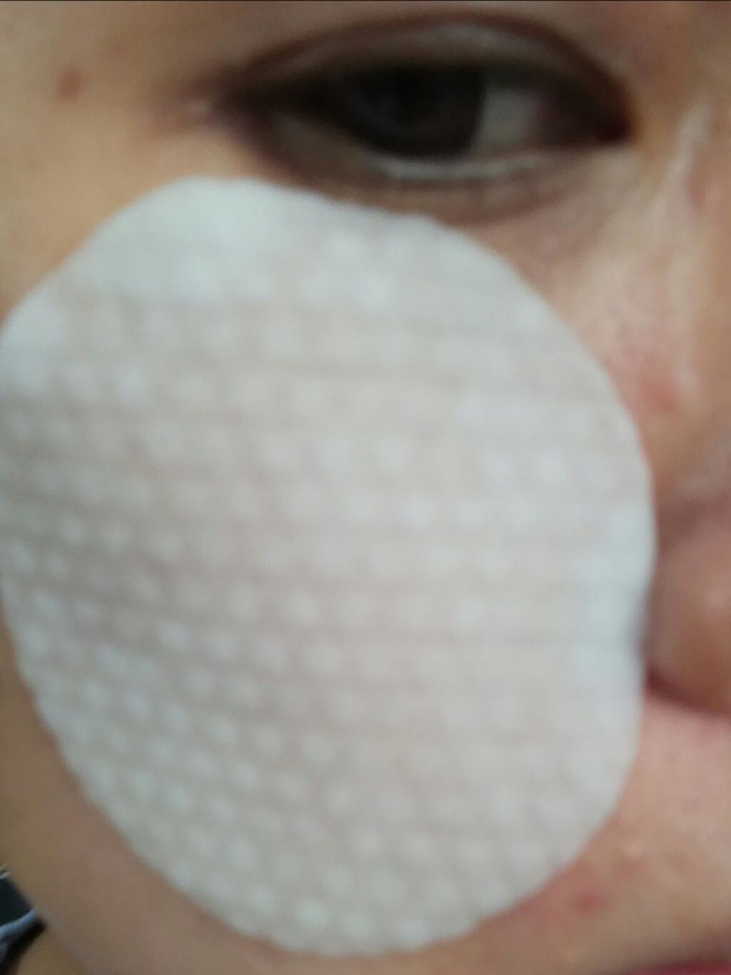 ティーツリーカーミングエッセンスパッド/MEDIHEAL/トナーパッドを使ったクチコミ(5枚目)