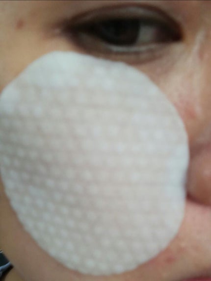 ティーツリーカーミングエッセンスパッド/MEDIHEAL/トナーパッドを使ったクチコミ(5枚目)