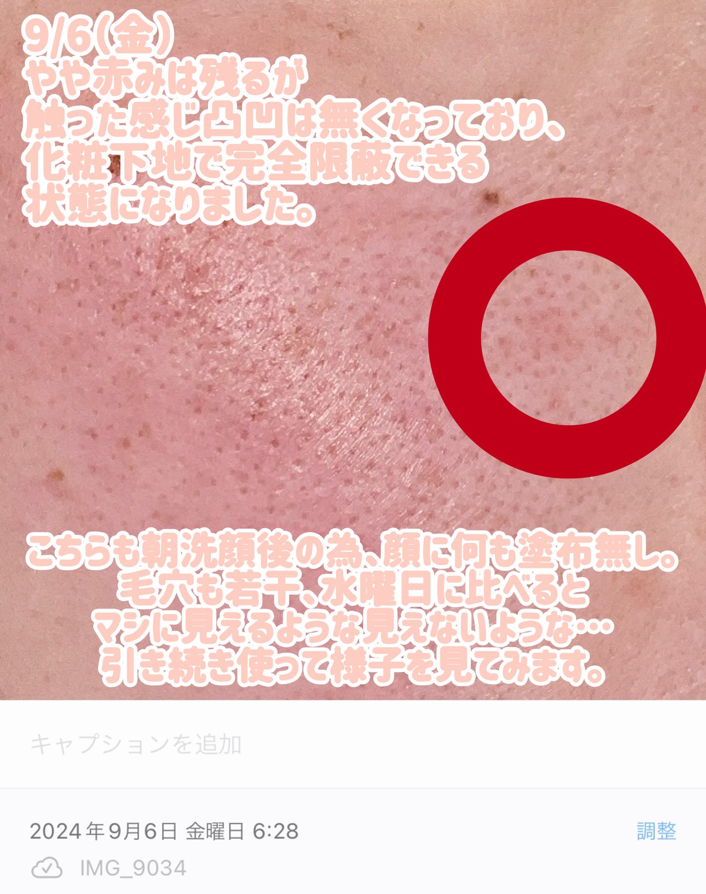 RXザ・ナイアシンアミド15セラム  /COSRX/美容液を使ったクチコミ(5枚目)