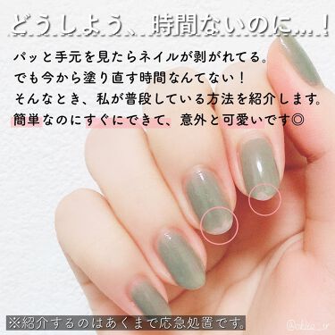 カラフルネイルズ キャンメイクを使った口コミ Selfnail 剥がれたネイルの応急処置 By アヤ 乾燥肌 10代後半 Lips