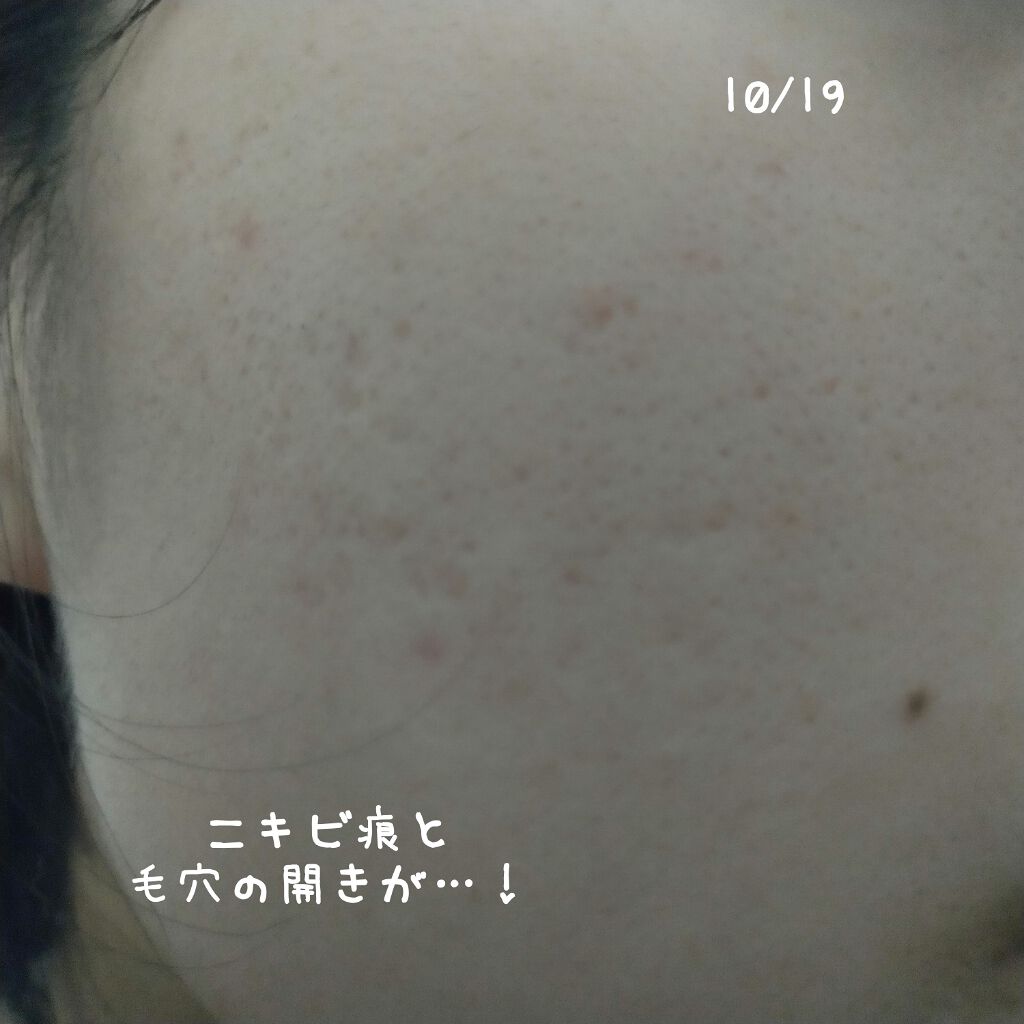 泥炭石 洗顔石鹸/ペリカン石鹸/洗顔石鹸を使ったクチコミ(5枚目)