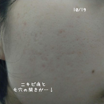 泥炭石 洗顔石鹸/ペリカン石鹸/洗顔石鹸を使ったクチコミ(5枚目)