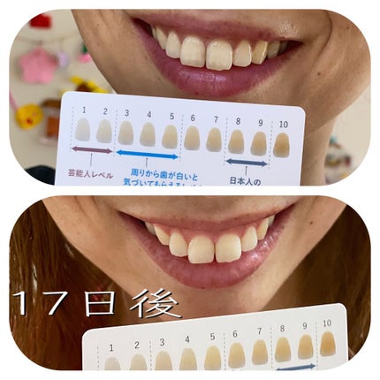 ルルホワイト/ルルシア/その他オーラルケアを使ったクチコミ(6枚目)