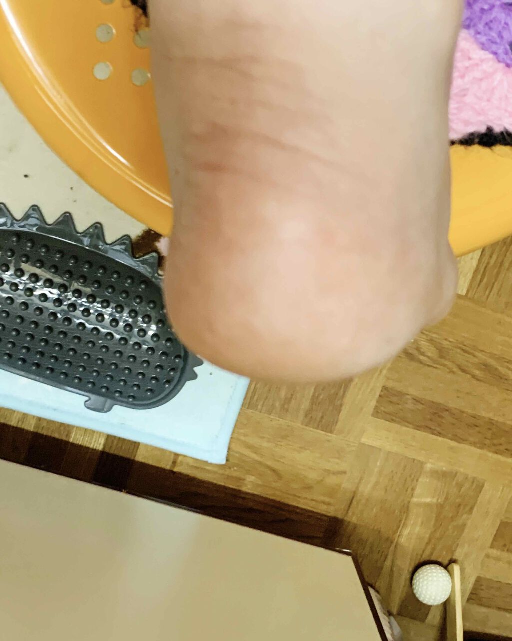 DETクリア ブライト&ピール ピーリングジェリー <ミックスベリーの香り>/Detclear/ピーリングを使ったクチコミ(3枚目)