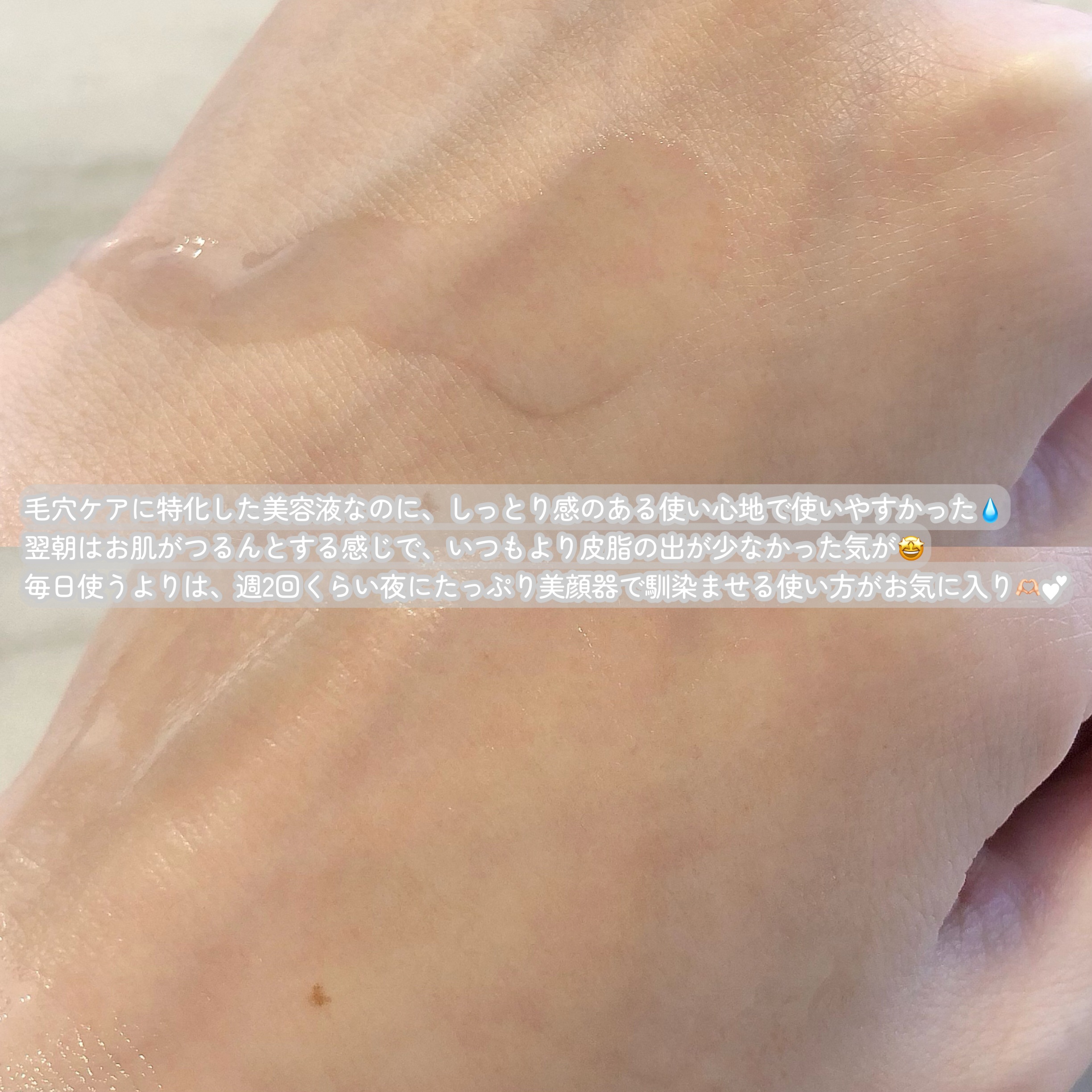 ゼロ毛穴1DAYセラム/MEDICUBE/美容液を使ったクチコミ（3枚目）