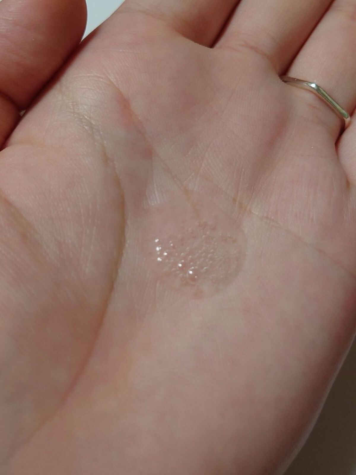 フェイシャルセラム/Amelie/美容液を使ったクチコミ（2枚目）