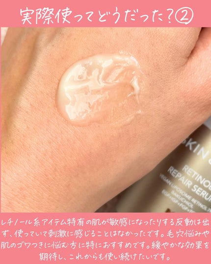 ヴィーガンリポソームレチノールセラム/SKIN&LAB/美容液を使ったクチコミ(4枚目)