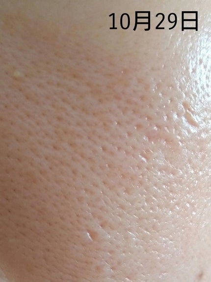 潤浸保湿 乳液/キュレル/乳液を使ったクチコミ(4枚目)