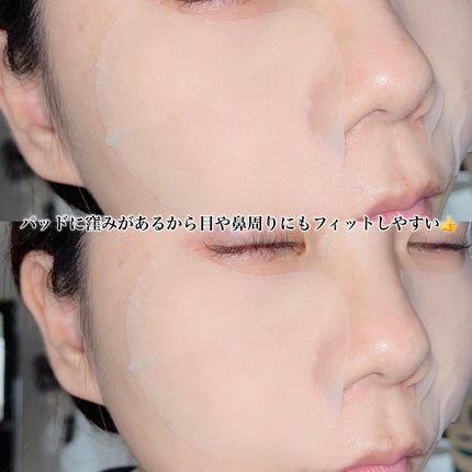 センテラ クイックカーミングパッド/SKIN1004/トナーパッドを使ったクチコミ(4枚目)