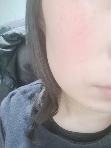 ユース ラディアンス ビタチノール セラム/primera/美容液を使ったクチコミ(5枚目)