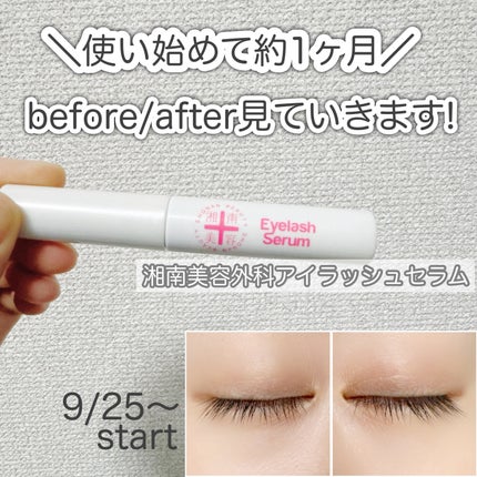 湘南美容まつ毛美容液/Co-medical+/まつげ美容液を使ったクチコミ(1枚目)