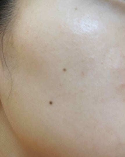 デュオ ザ クレンジングバーム クリア/DUO/クレンジングバームを使ったクチコミ(2枚目)