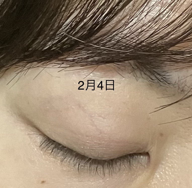 スカルプD ボーテ ピュアフリーアイラッシュセラム　プレミアム/アンファー(スカルプD)/まつげ美容液を使ったクチコミ（3枚目）