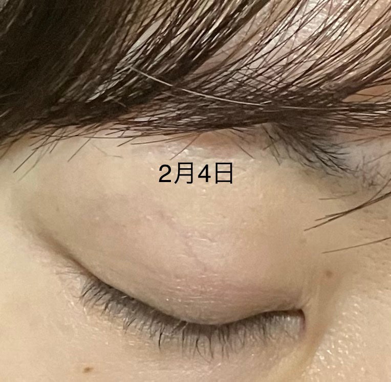 スカルプD ボーテ ピュアフリーアイラッシュセラム プレミアム/アンファー(スカルプD)/まつげ美容液を使ったクチコミ(3枚目)