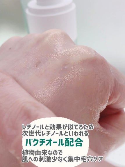 シカレチA エッセンス0.1/VT/美容液を使ったクチコミ(4枚目)