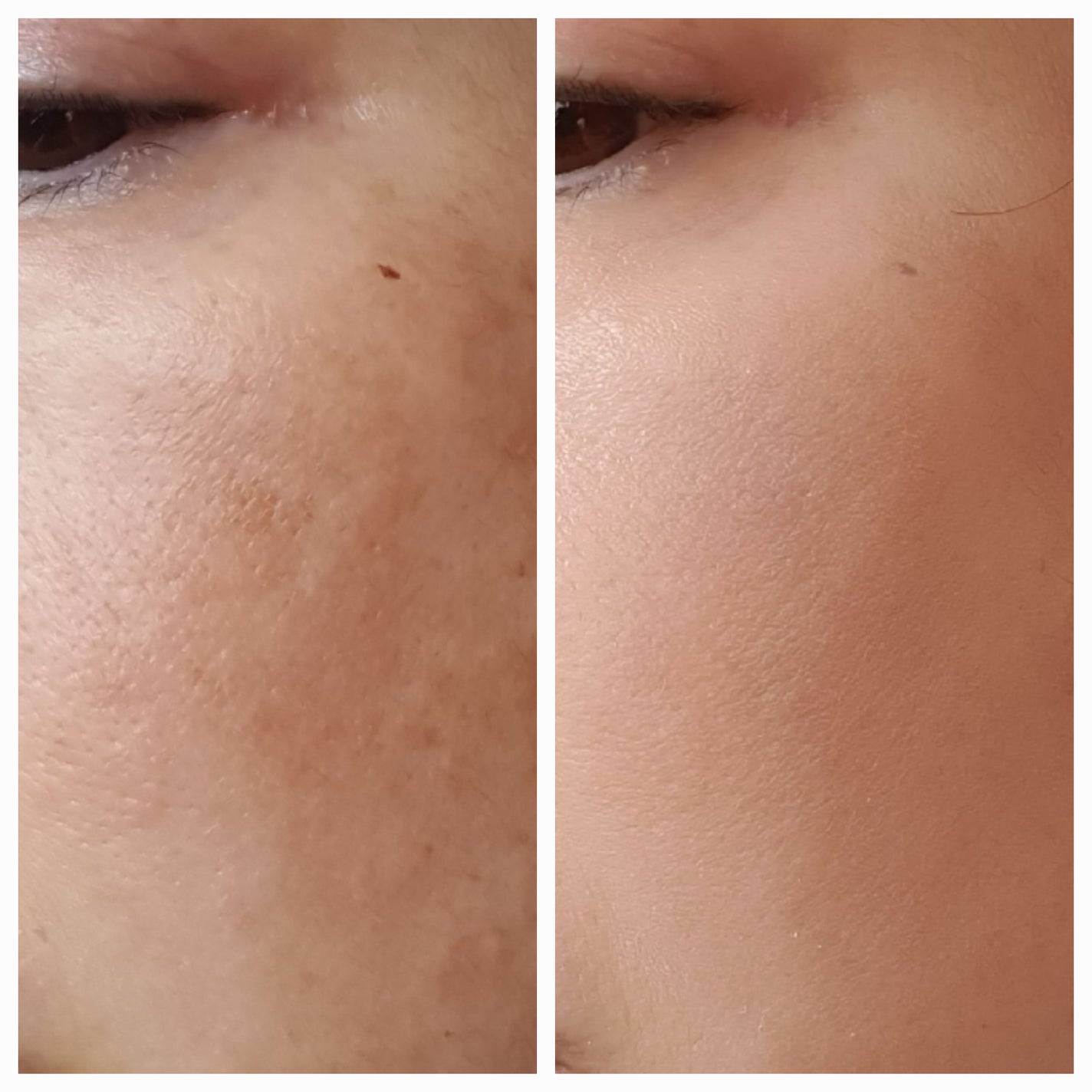 エスポア ビーグロー ボリュームクッション/espoir/クッションファンデーションを使ったクチコミ(3枚目)