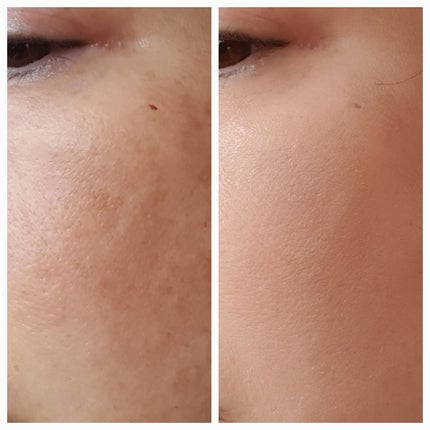 エスポア ビーグロー ボリュームクッション/espoir/クッションファンデーションを使ったクチコミ(3枚目)