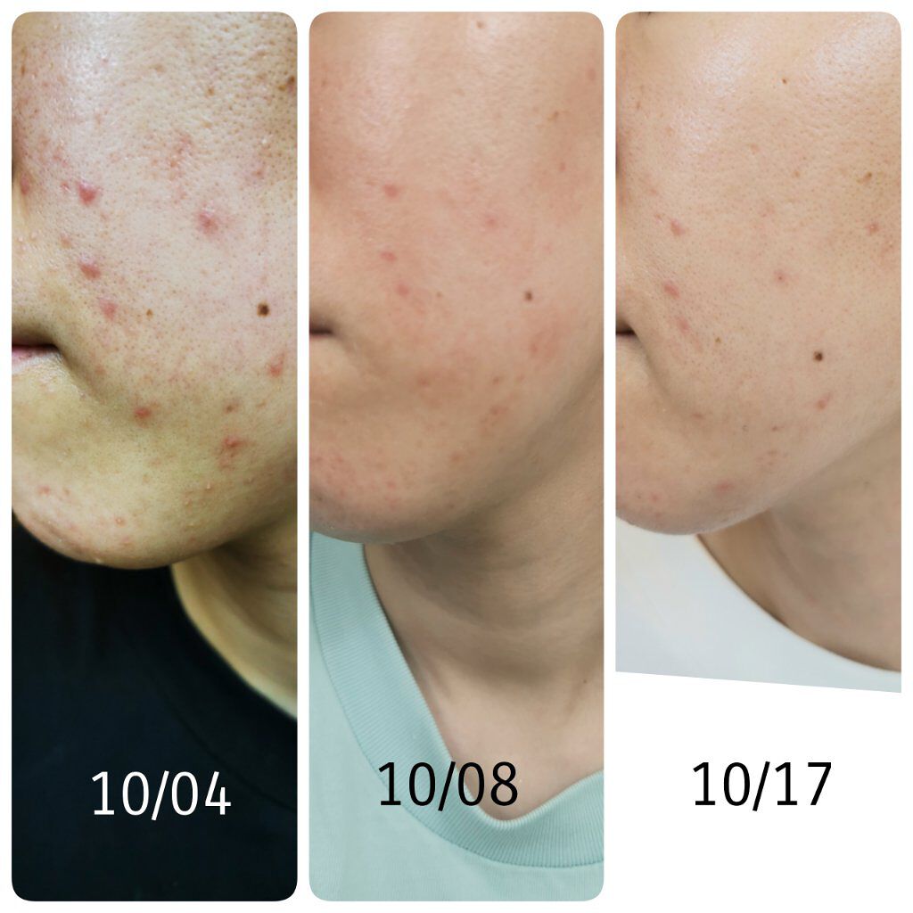 クリアウォッシュ/オルビス/洗顔フォームを使ったクチコミ(3枚目)