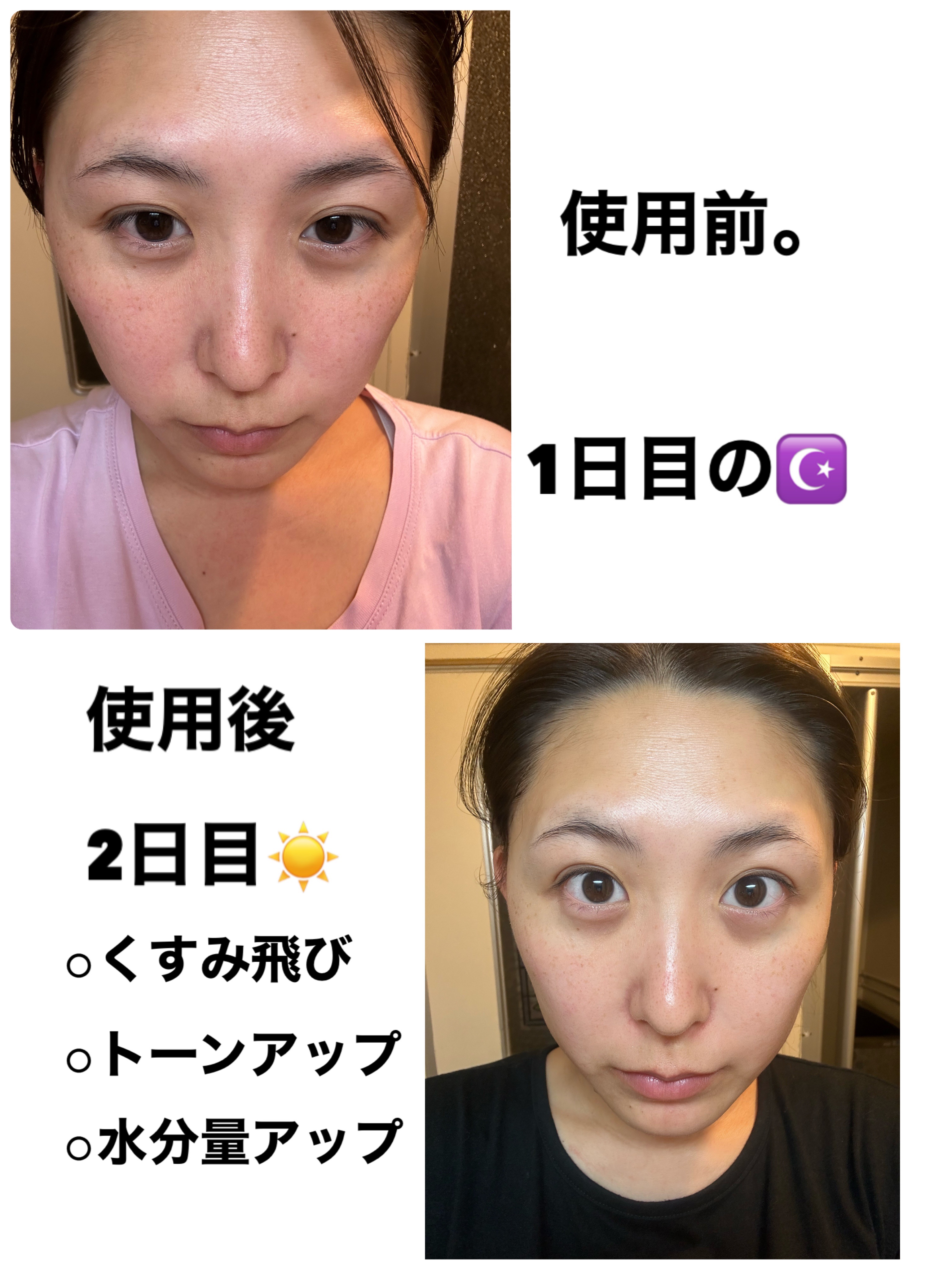 S100 レチAリードル/VT/美容液を使ったクチコミ（2枚目）