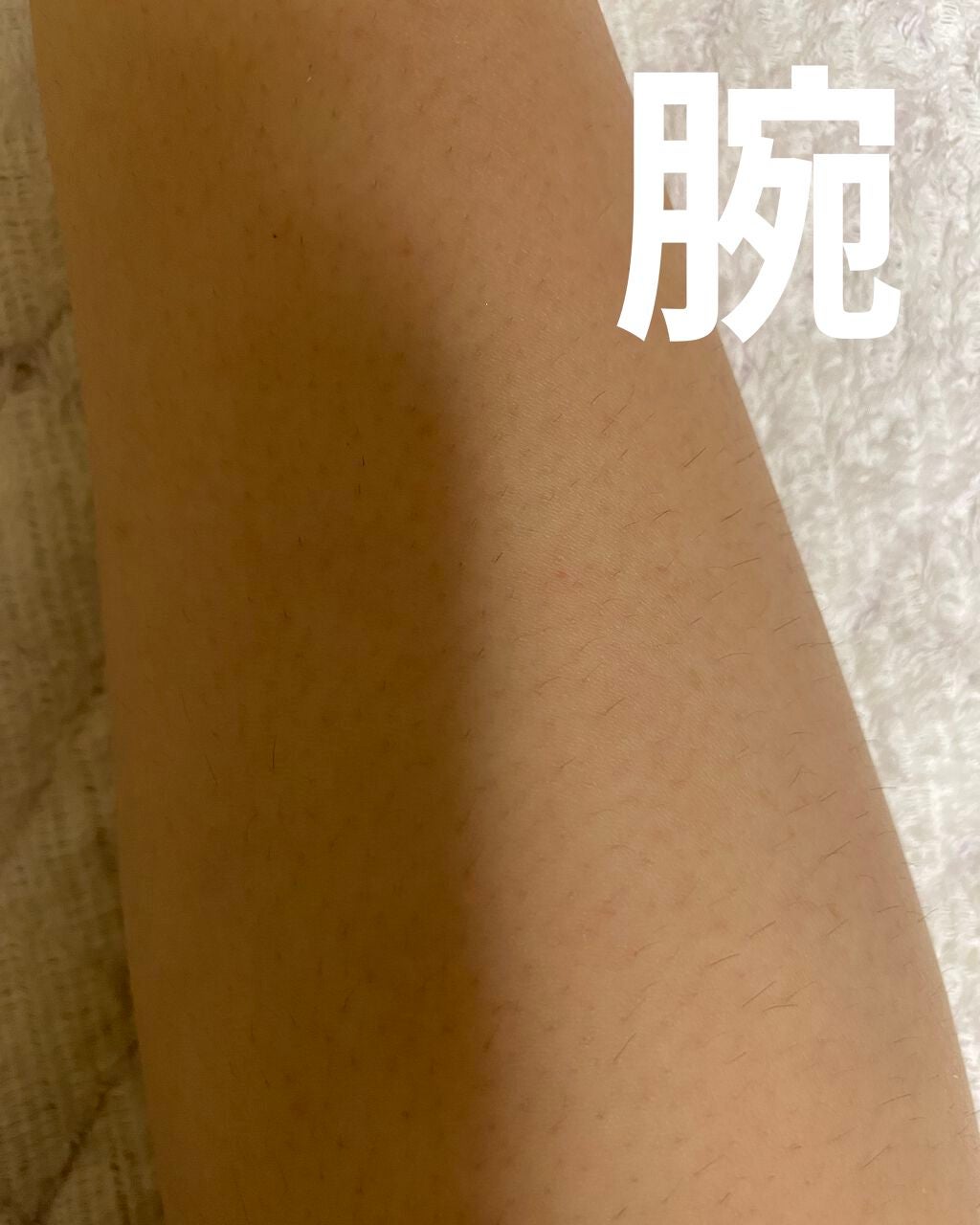 FASIZ607C IPL光脱毛器/FASIZ/家庭用脱毛器を使ったクチコミ(3枚目)