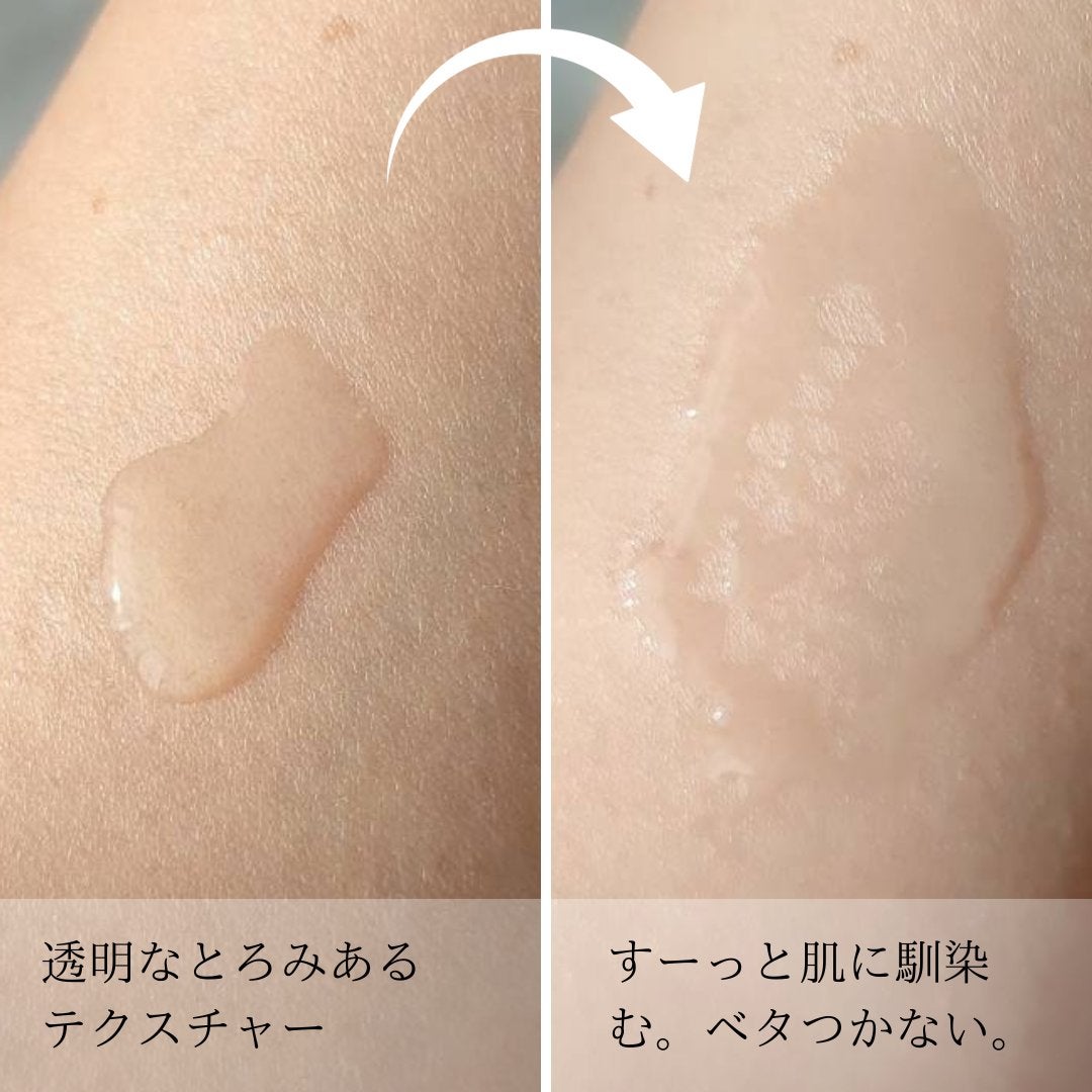 アクアヒアルロニックエッセンス/ロベクチン/化粧水を使ったクチコミ(3枚目)