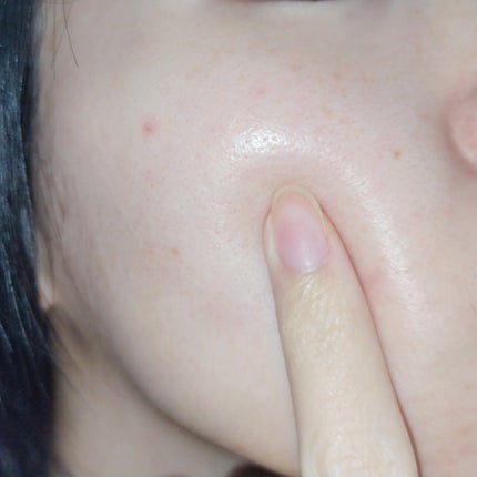 薬用マイクロバブルローション/Macchia Label/化粧水を使ったクチコミ(3枚目)