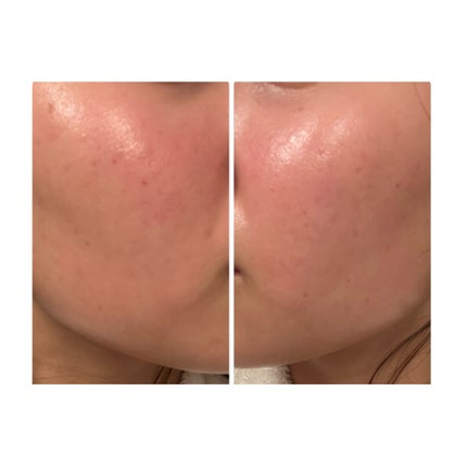 を使ったクチコミ(3枚目)