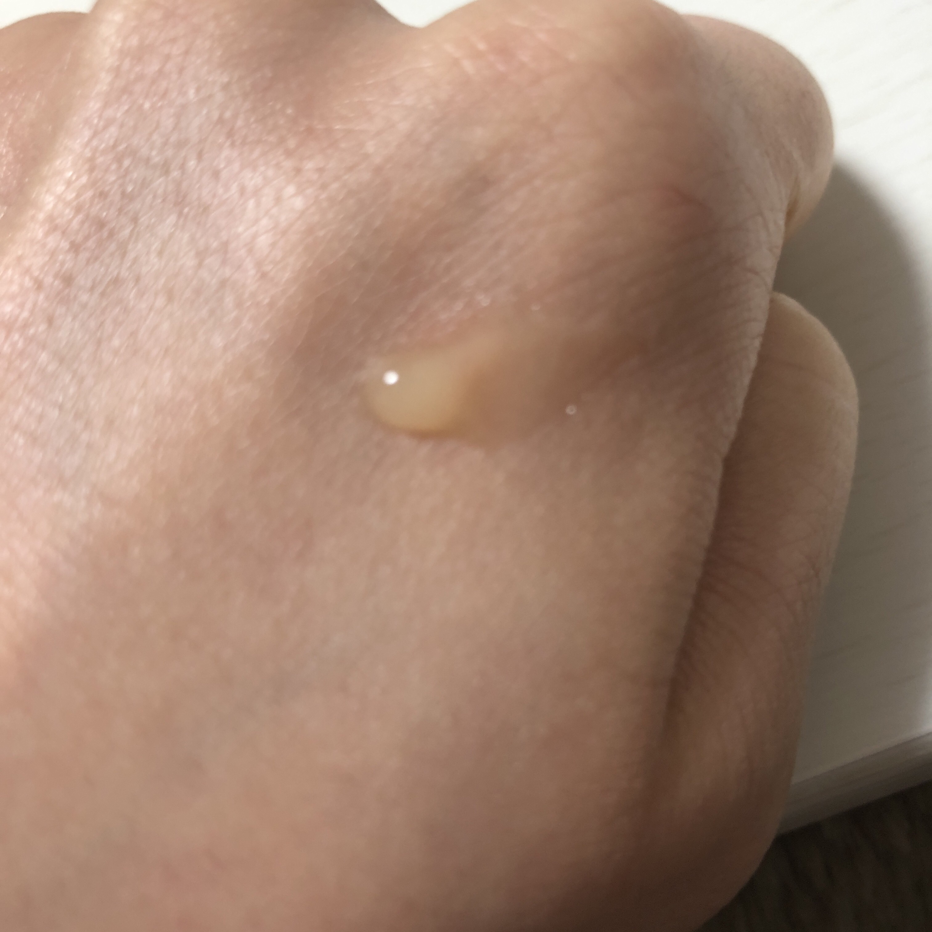 リンクルリップエッセンス/ザ・レチノタイム/リップ美容液を使ったクチコミ（2枚目）