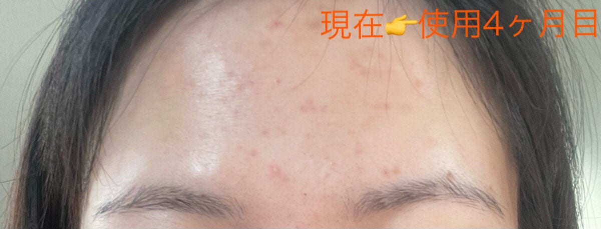 ザビタミンC23/IOPE/美容液を使ったクチコミ(3枚目)