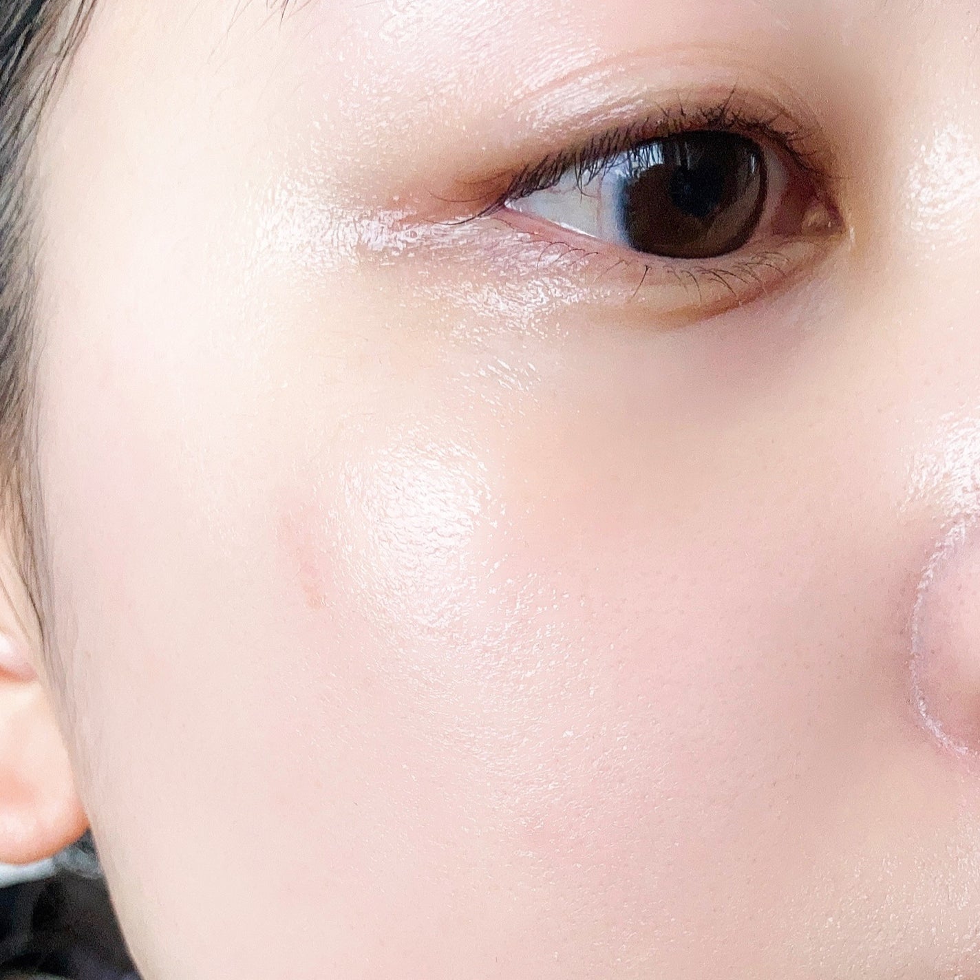 リードルショット100/VT/美容液を使ったクチコミ(7枚目)