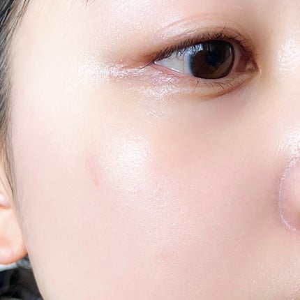 リードルショット100/VT/美容液を使ったクチコミ(7枚目)