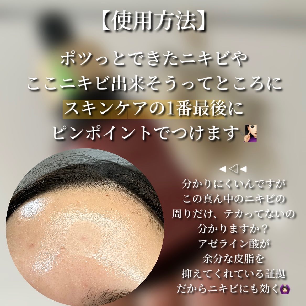 AZアゼライン酸10セラム/コスデバハ/美容液を使ったクチコミ(3枚目)