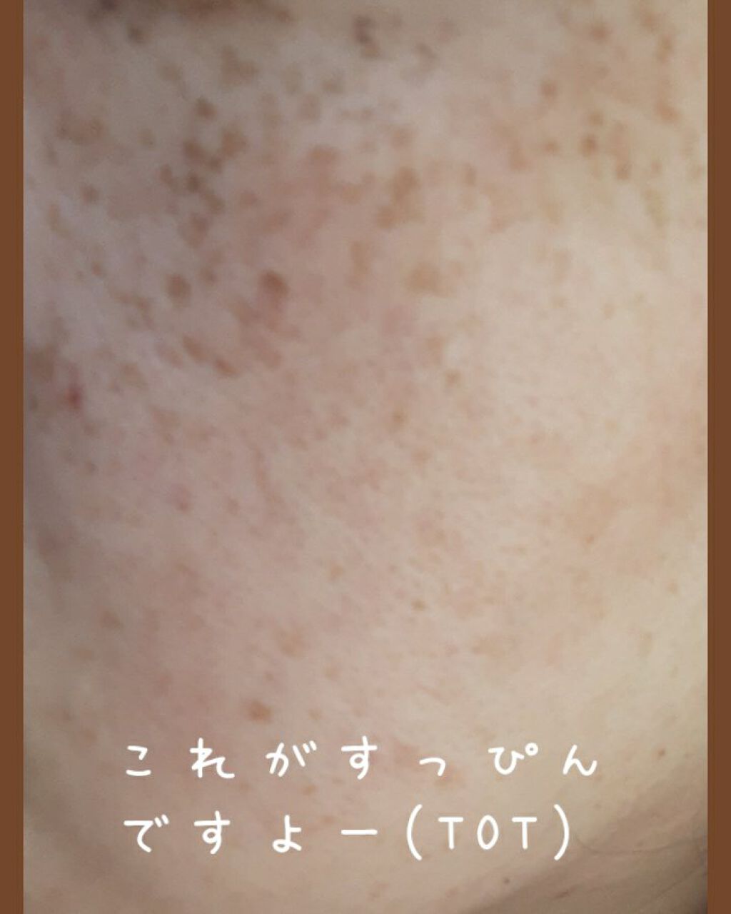 フローレス フィット/COVERMARK/クリーム・エマルジョンファンデーションを使ったクチコミ(2枚目)