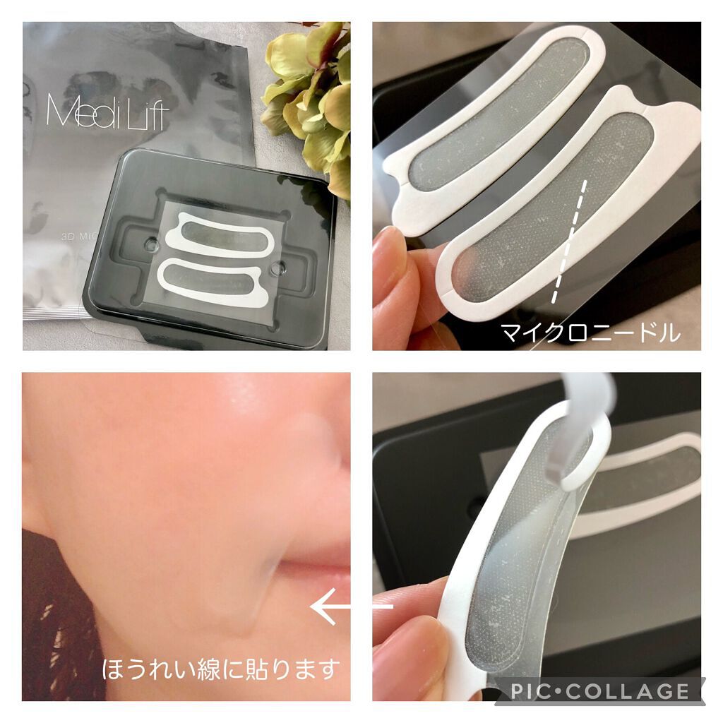 メディリフト 3Dマイクロフィラー(口元用)/YA-MAN TOKYO JAPAN/シートマスク・パックを使ったクチコミ（3枚目）