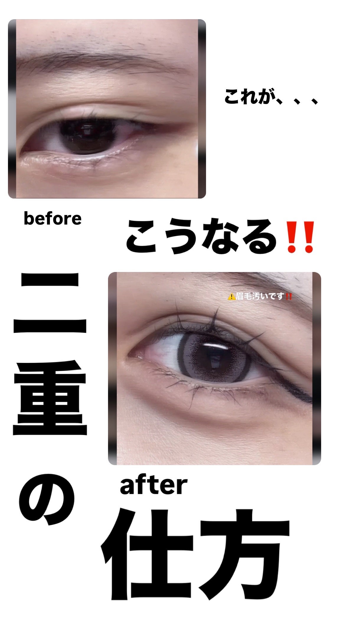 のびーるアイテープ(絆創膏タイプ、レギュラー)/DAISO/二重まぶた用アイテムを使ったクチコミ(1枚目)