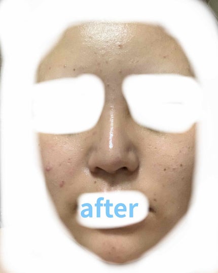 グリーンタンジェリン ビタC ダークスポットケアセラム/goodal/美容液を使ったクチコミ(2枚目)