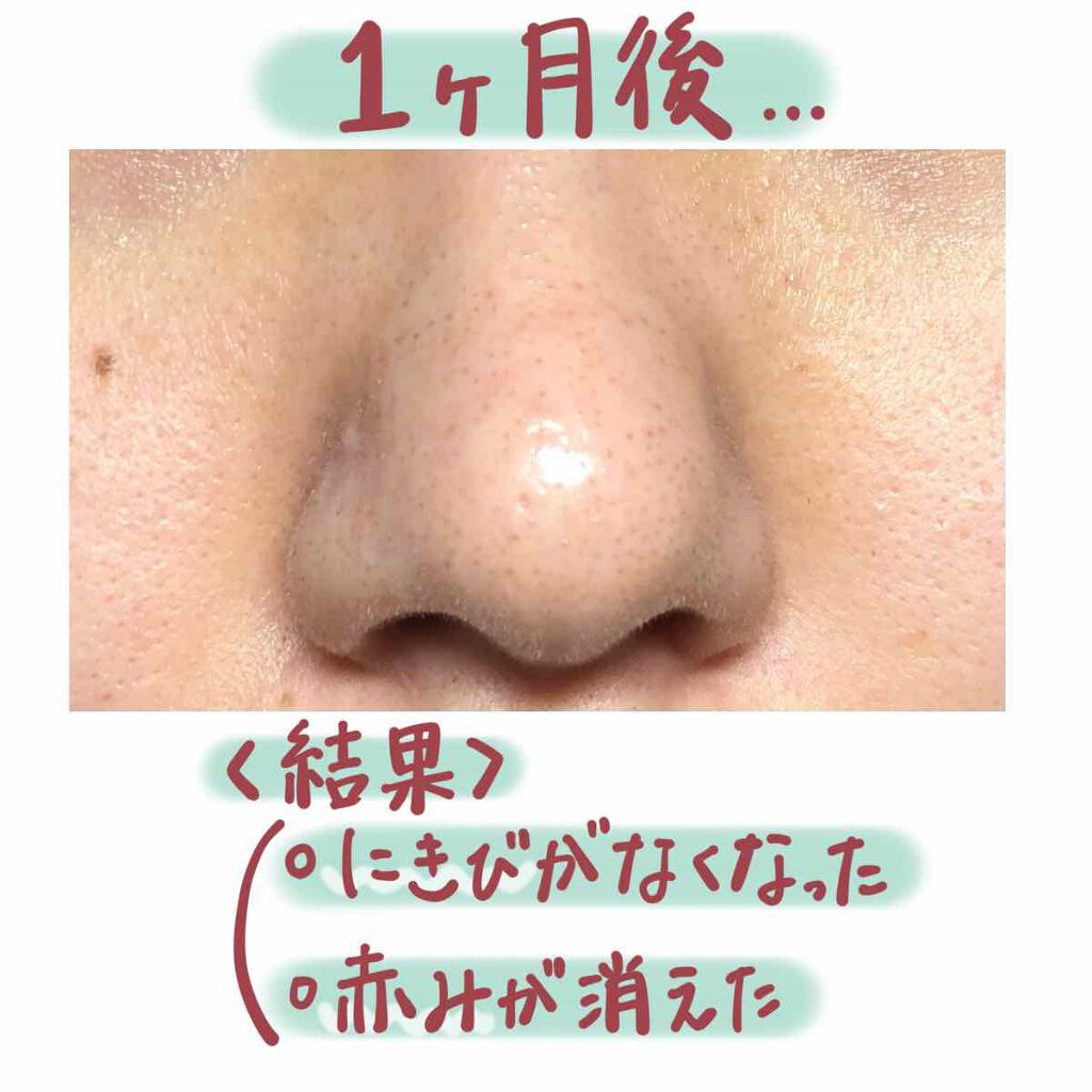 マデカクリーム/センテリアン24/フェイスクリームを使ったクチコミ(5枚目)