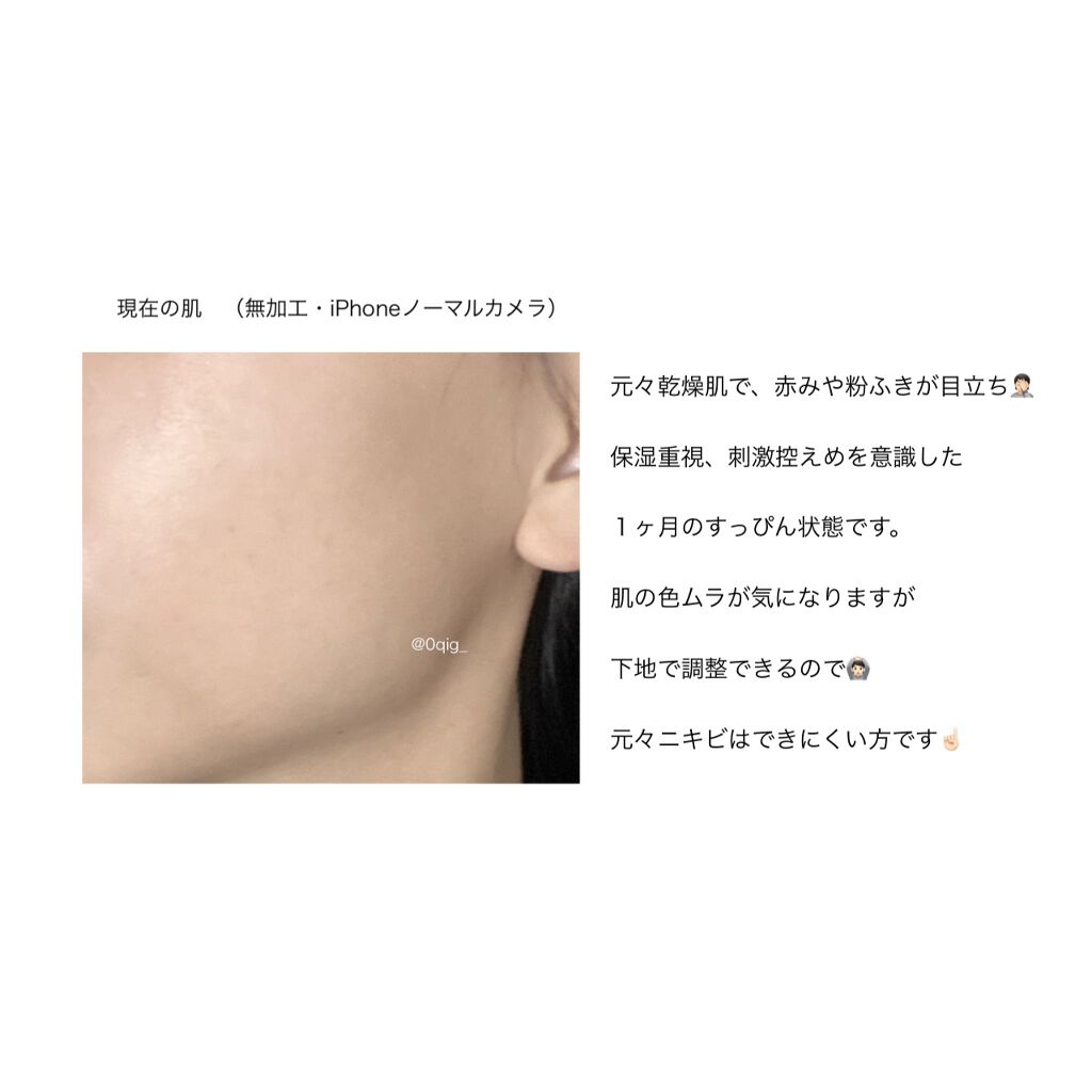 ハトムギ化粧水(ナチュリエ スキンコンディショナー R )/ナチュリエ/化粧水を使ったクチコミ(6枚目)