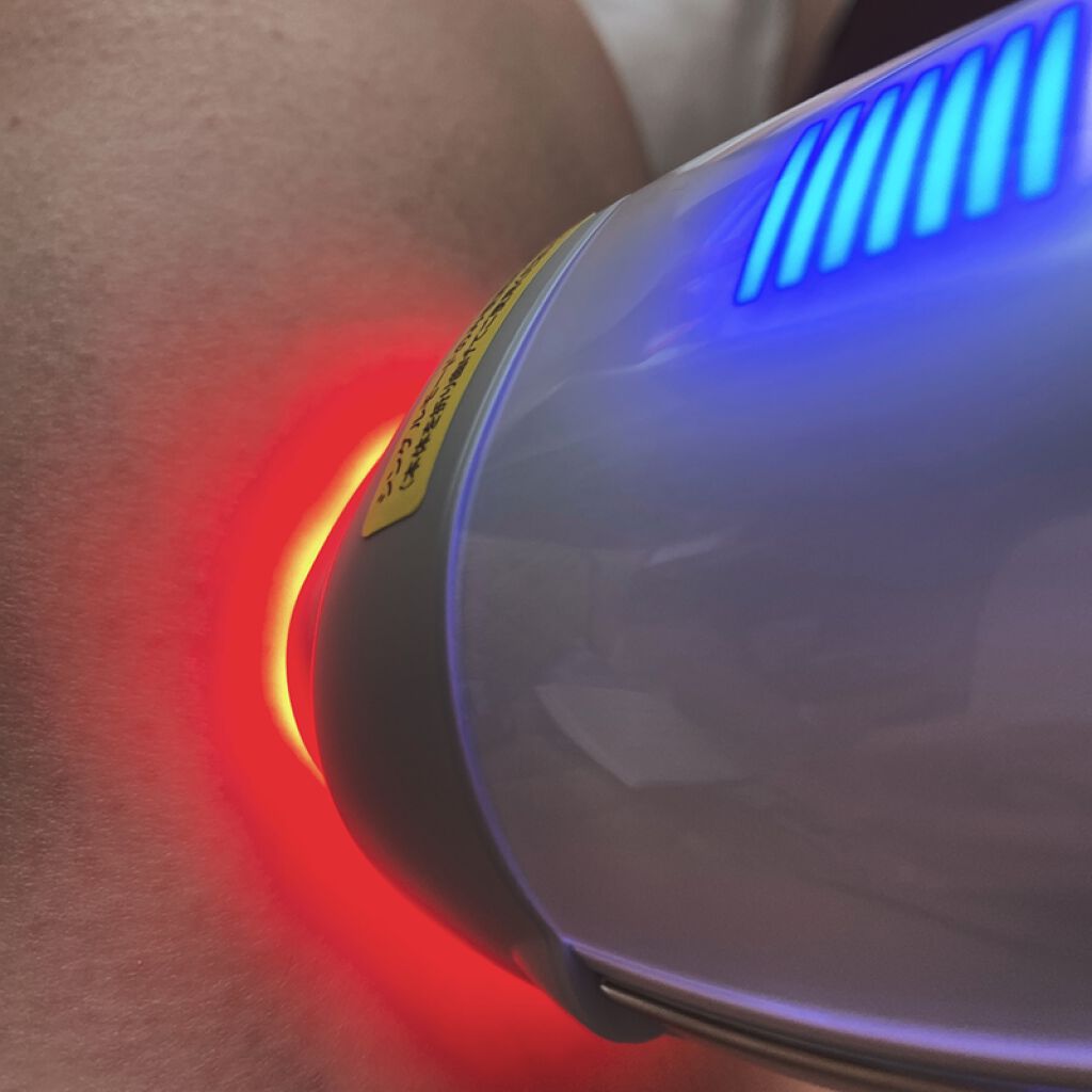 レイボーテRフラッシュ ハイパー/YA-MAN TOKYO JAPAN/家庭用脱毛器を使ったクチコミ（3枚目）