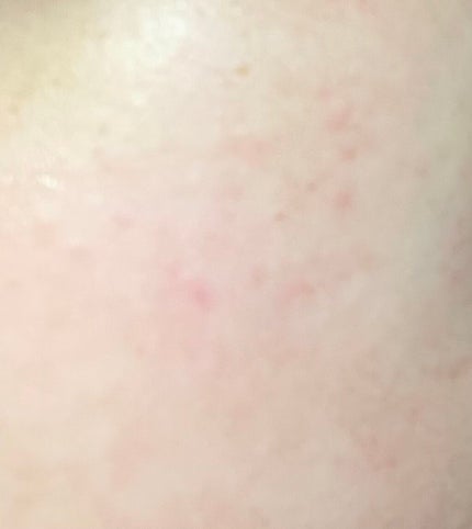 CICA デイリースージングマスク/VT/シートマスク・パックを使ったクチコミ(2枚目)