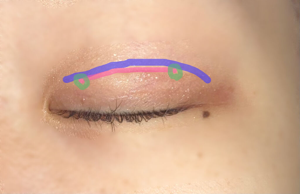 のびーるアイテープ（絆創膏タイプ、レギュラー）/DAISO/二重まぶた用アイテムを使ったクチコミ（3枚目）