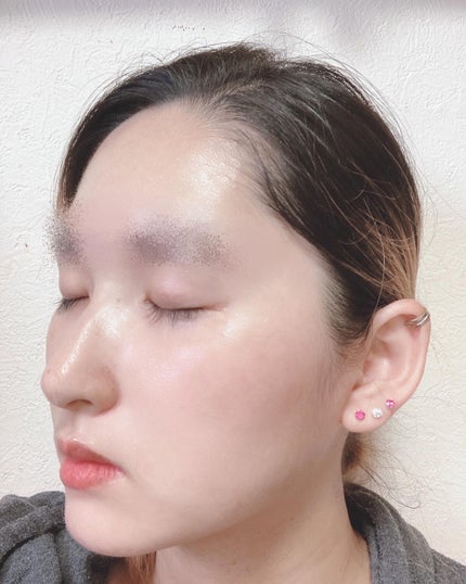 ヒアロディープパッチ/北の快適工房/シートマスク・パックを使ったクチコミ(6枚目)