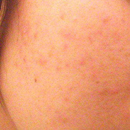 敏感肌用薬用美白美容液/無印良品/美容液を使ったクチコミ(3枚目)