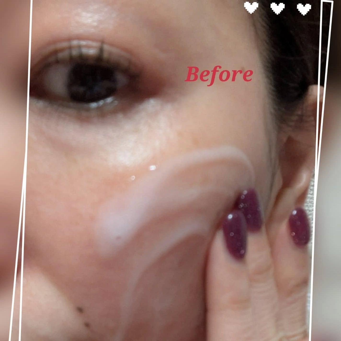 プロバイオシカ インテンシブ アンプル/SKIN1004/美容液を使ったクチコミ(6枚目)