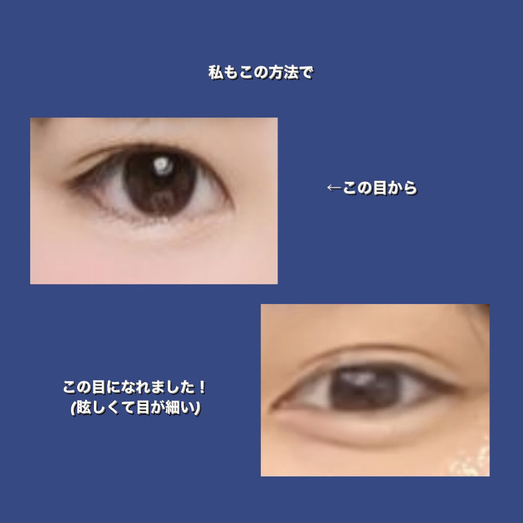 のびーるアイテープ（絆創膏タイプ、レギュラー）/DAISO/二重まぶた用アイテムを使ったクチコミ（2枚目）