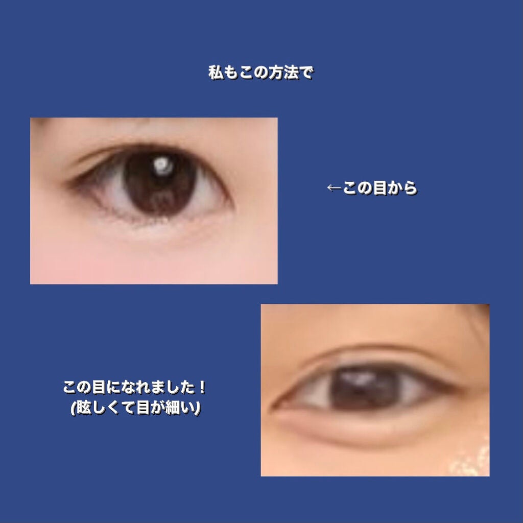 のびーるアイテープ(絆創膏タイプ、レギュラー)/DAISO/二重まぶた用アイテムを使ったクチコミ(2枚目)