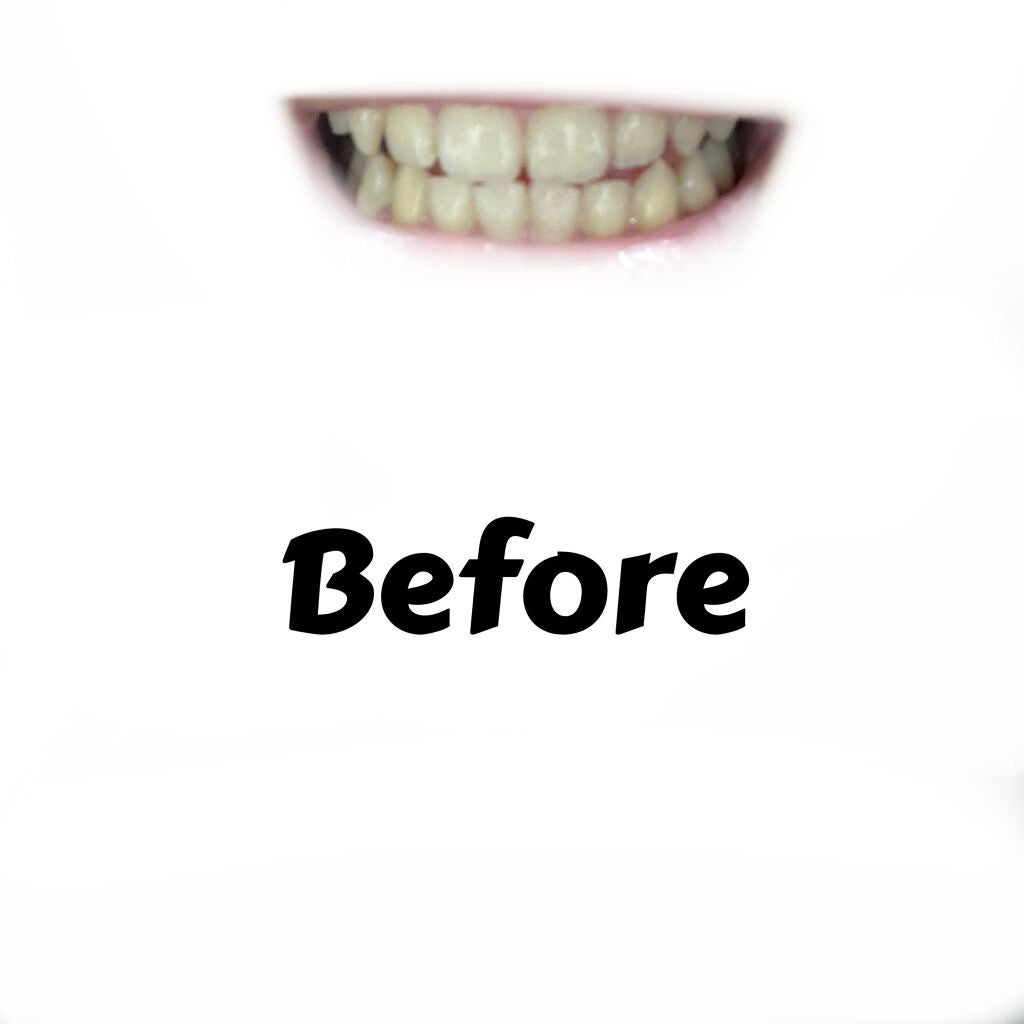 オーラツー プレミアム クレンジングペースト プレミアムミント/オーラツー/歯磨き粉を使ったクチコミ(2枚目)